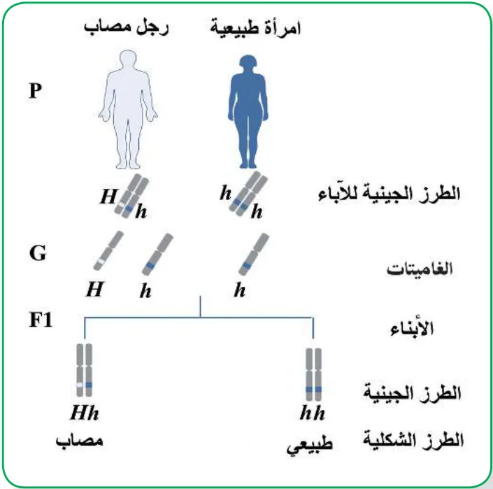 الشكل (6): توارث الإصابة بمرض هنتنغتون
