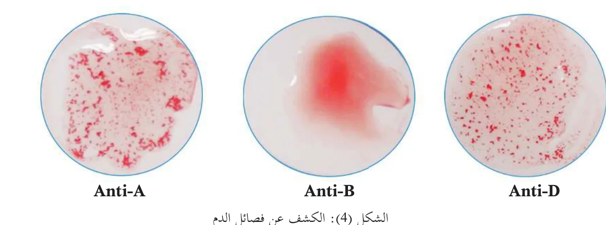 الشكل (4): الكشف عن فصائل الدم