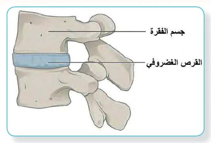 الشكل (14): مفصل محدود الحركة