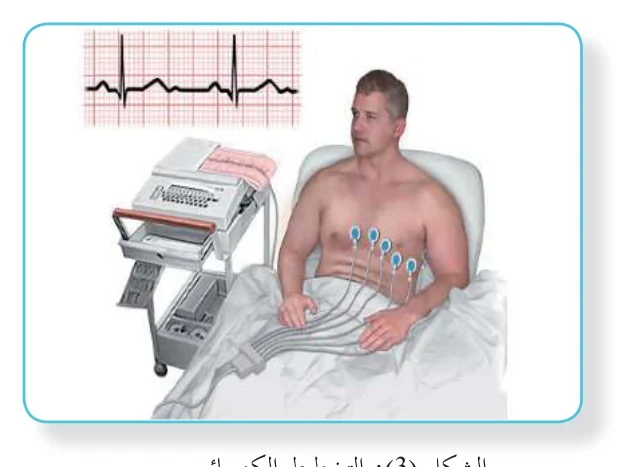 الشكل (3): التخطيط الكهربائي