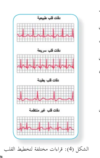الشكل (4): قراءات مختلفة لتخطيط القلب