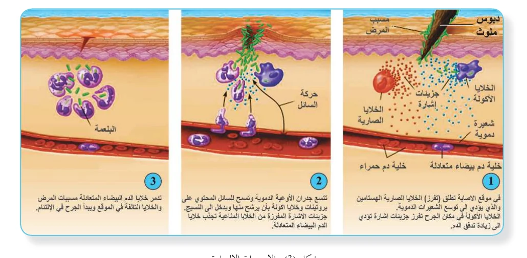 الشكل (3): الاستجابة الالتهابية
