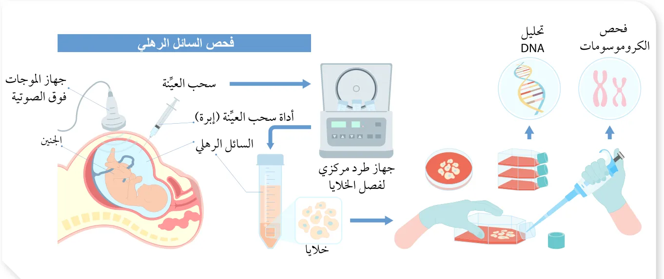 الشكل (42): فحص الاختلالات الوراثية بأخذ عينة من السائل الرهلي.