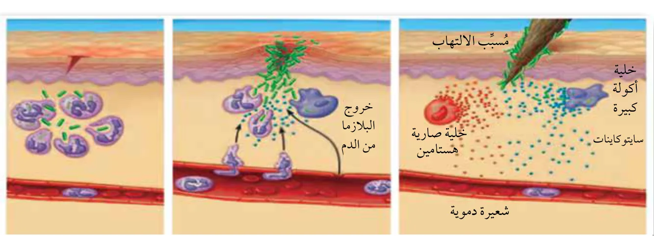 الشكل (6): الاستجابة الالتهابية.
