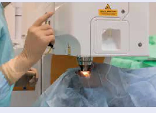 استخدام أشعة الليزر في الطب.
